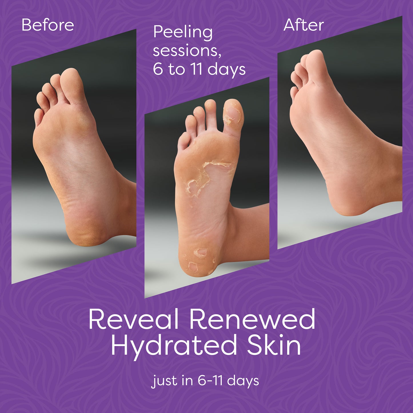 Aesta Foot Peel Mask