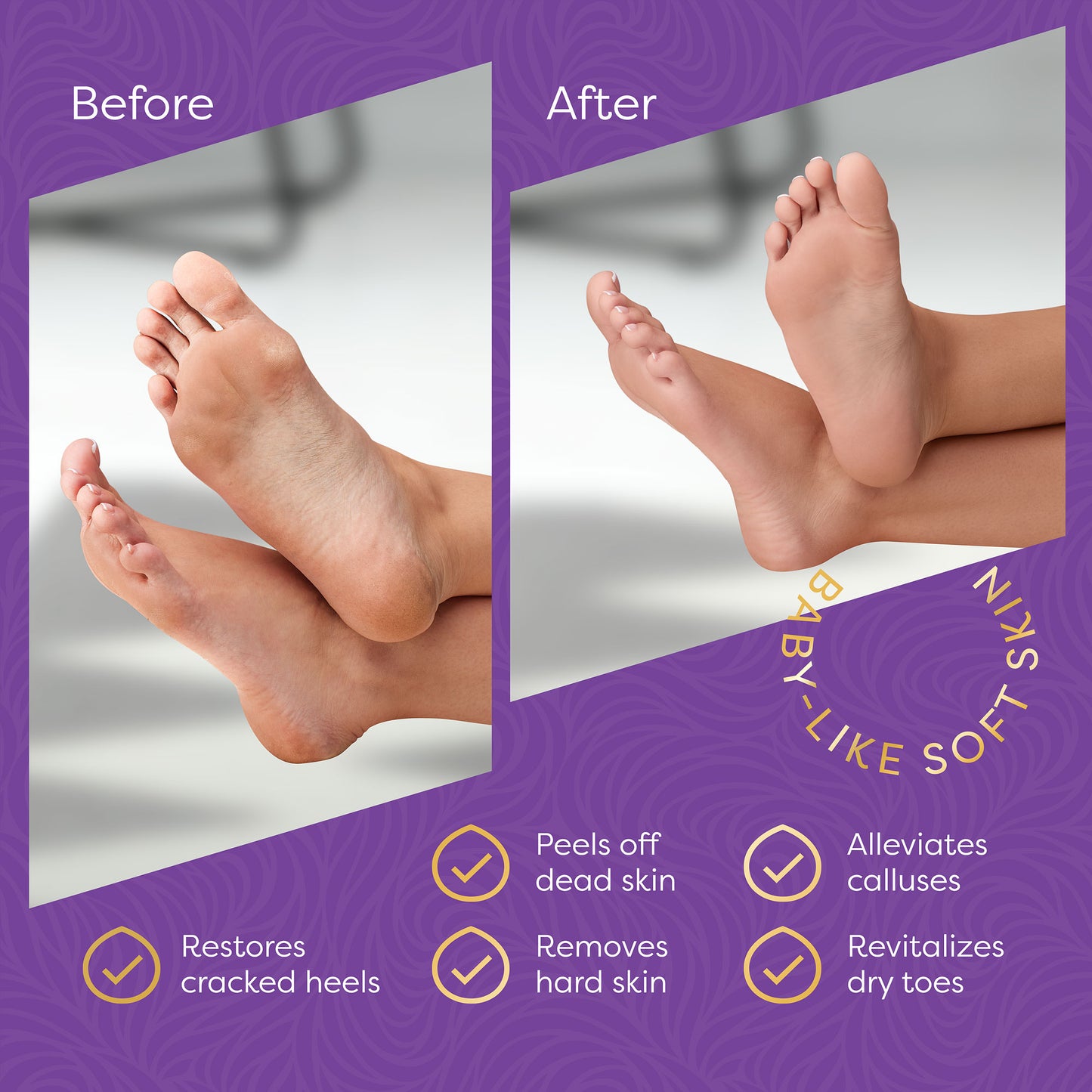 Aesta Foot Peel Mask